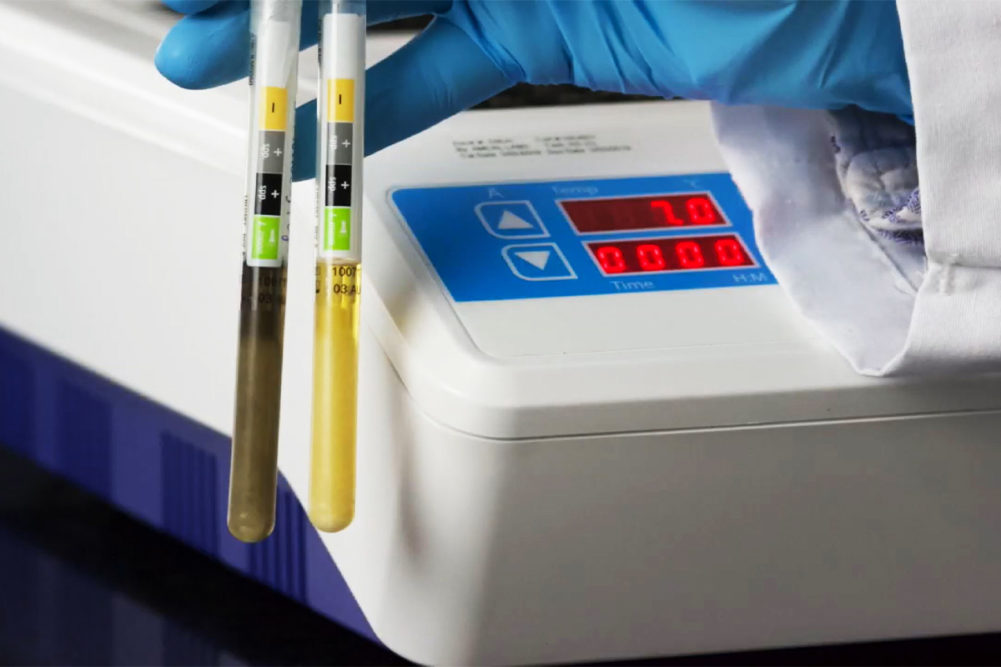 Hygiena introduces new environmental test for detecting Listeria monocytogenes